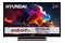 Telewizor HYUNDAI HLA24551CAR 24" HD Ready